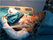 Bóng đá anh, ngoại hạng anh, lịch thi đấu euro 2012, Tay bé Trịnh Thị Bích đã hồi phục được tới 70-80% 